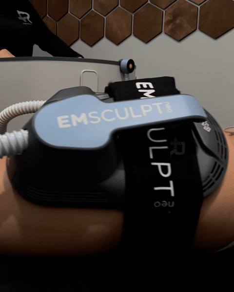 Get Ready for Your EMSCULPT NEO Treatment A Step by Step Guide to Preparation remedy