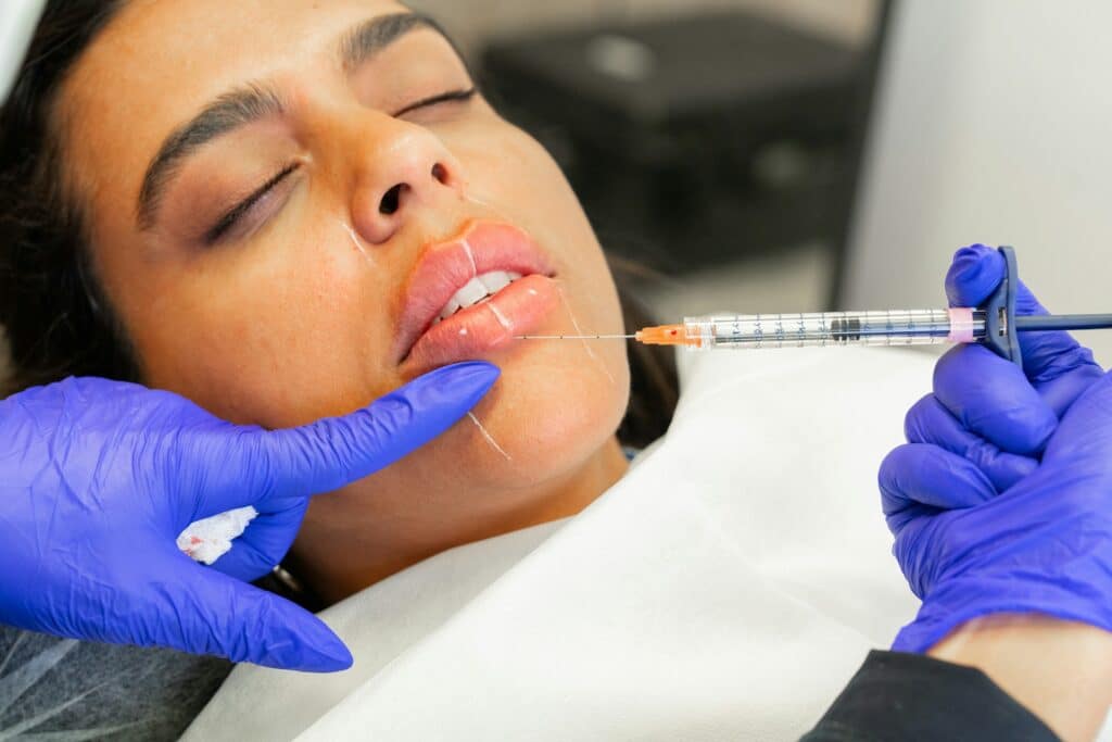 Lip Filler