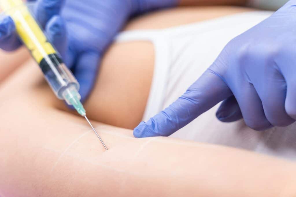 Injections