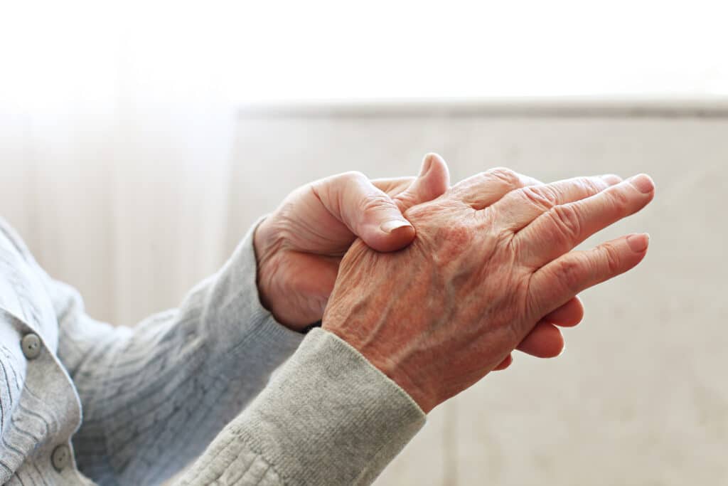 Close up of an elderly woman applying lotion to her hands and arms, in need of microneedling to repair crepey skin